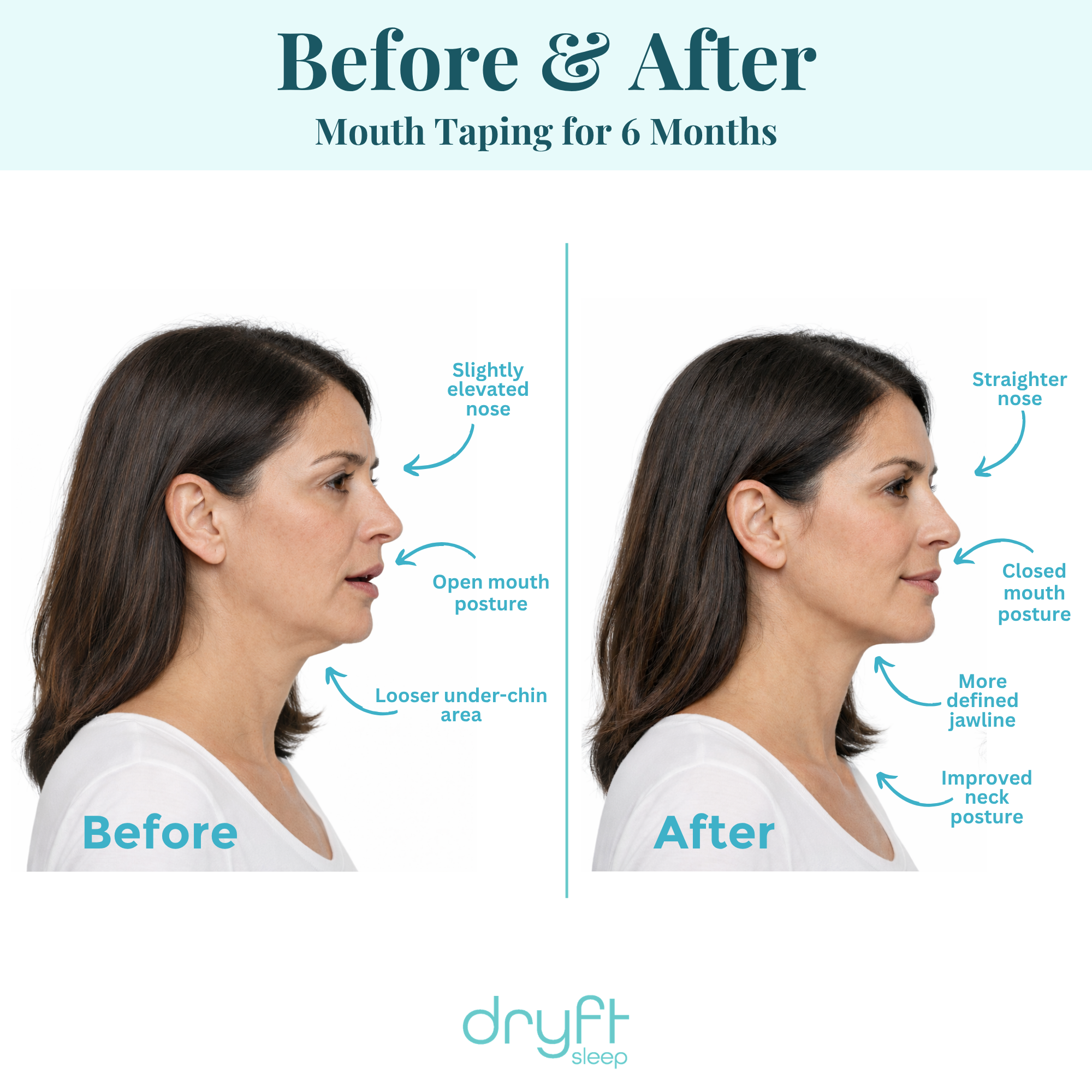 Dryft Sleep Mouth Tape